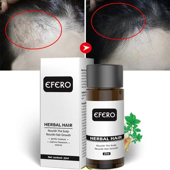Efero 20ml Plaukų Augimą Eteriniai Aliejai Plaukų, Barzdos Augimo Serumas plaukų slinkimo Produktų Plaukai Priežiūra