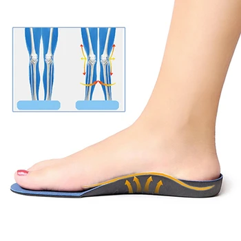 Flatfoot Orthotics Cubitus Varus Ortopedinė Kojų Pagalvėlės, Pagalvėlės Priežiūra, Įtvarai