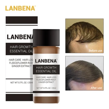 LANBENA Greitai Galingas Plaukų Augimo Esmė Produktų eterinis Aliejus Gydymo užkirsti Kelią Plaukų Slinkimas, Plaukų Priežiūros Andrea 20ml
