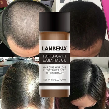 LANBENA Greitai Galingas Plaukų Augimo Esmė Produktų eterinis Aliejus Gydymo užkirsti Kelią Plaukų Slinkimas, Plaukų Priežiūros Andrea 20ml