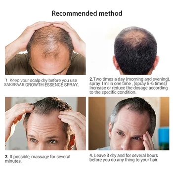 Plaukų Priežiūra Esmė Prevencijos Plaukų Slinkimas Efektyvų Augimą, Maitina Alyvos Kontrolės Balansas naftos sekrecijos