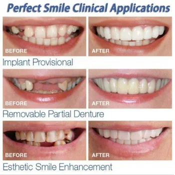 Viršutinės & apatinių Dantų Laminatės Anti-tiesa, Petnešos Snap On Smile Dantų Balinimas dantų Protezų, Dantų Patogus Lukštu Padengti Dantys