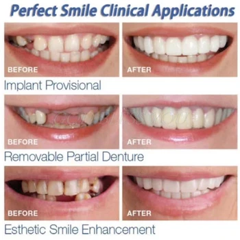 Viršutinės Klaidingas, Netikras Dantis Padengti Snap Momentinių Puikus Šypsena Kosmetikos Dantų Protezų Priežiūros Lašas Laivybos